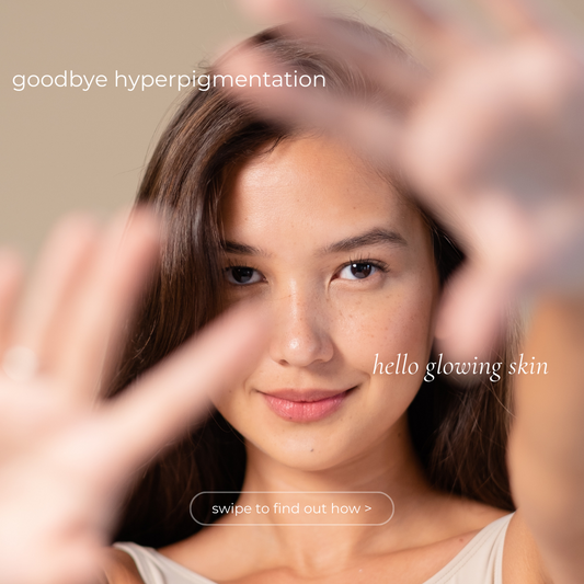What is Hyperpigmentation?